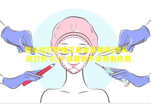 抬头纹打伊维兰真会反弹吗(抬头纹打针 🦢 去皱会不会有副作用反弹吗)